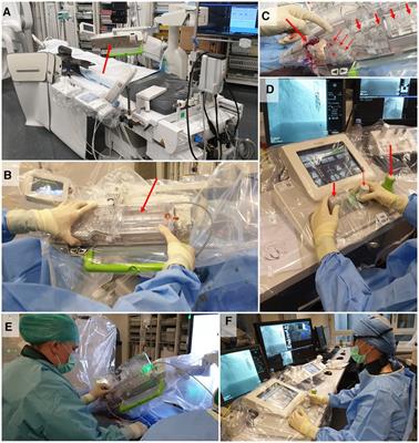 Robotic-assisted percutaneous coronary intervention: experience in Switzerland